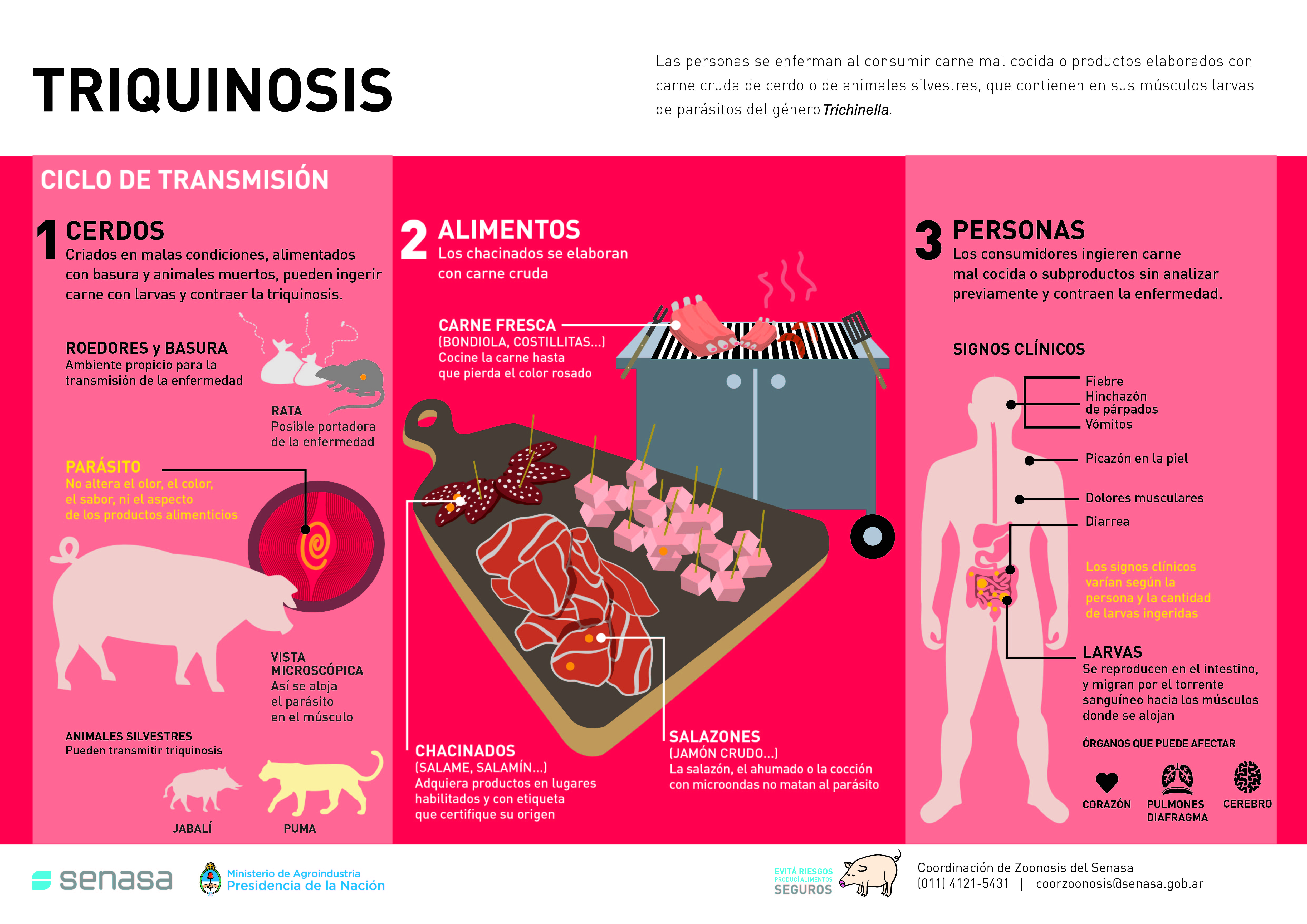 triquinosis
