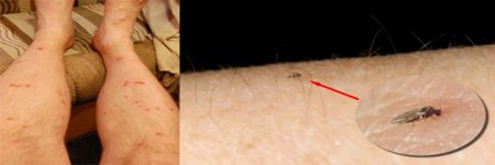 picaduras mosquito