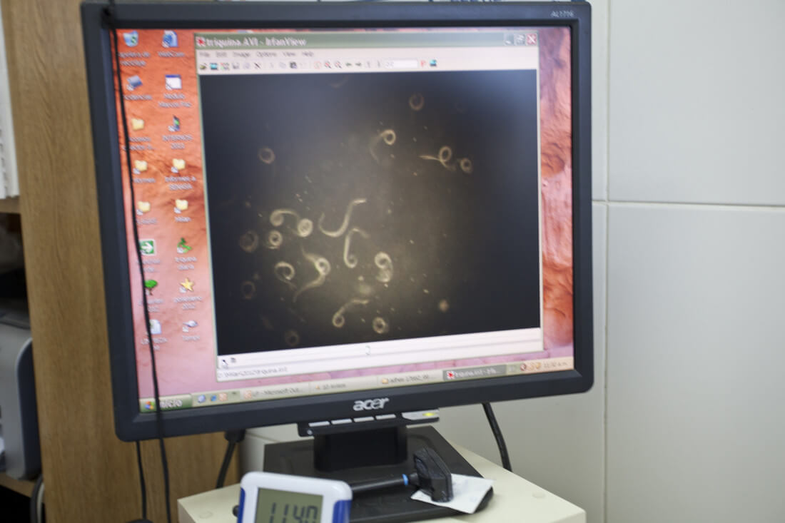 Triquinosis: las claves para prevenir la enfermedad en su época de mayor riesgo 2 img 20260518 wa0003